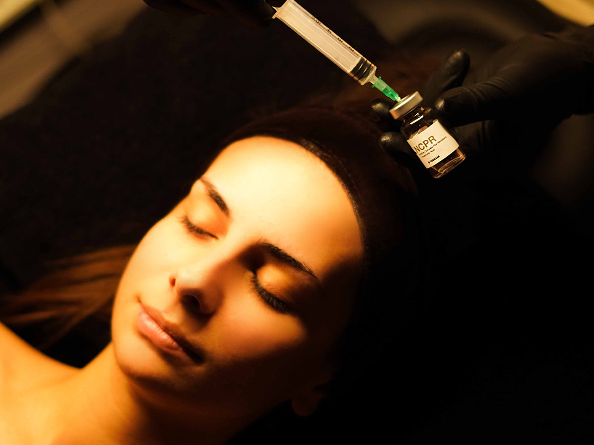 Microneedling